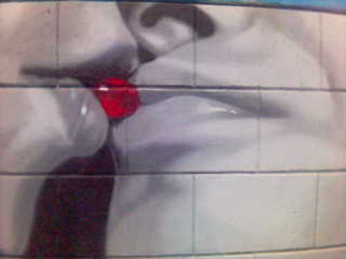 Medium_grafit_